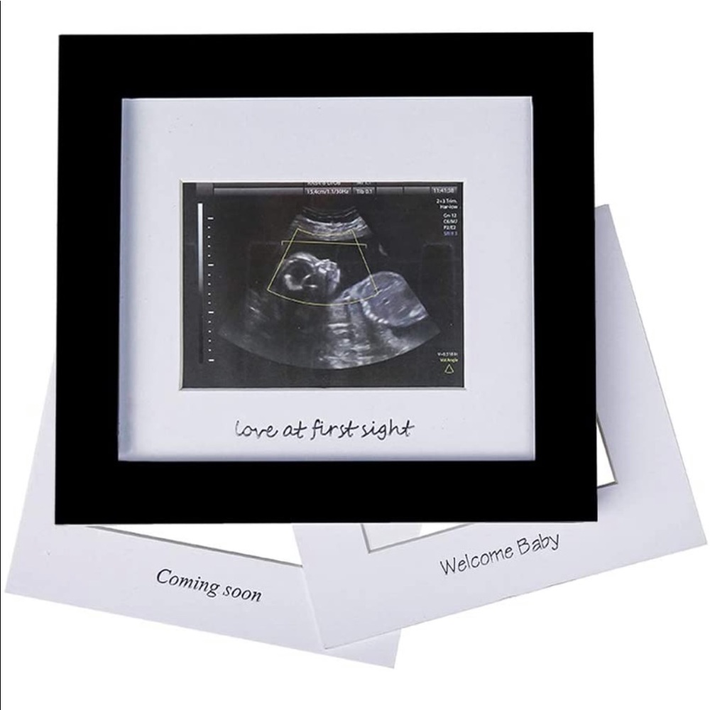 SONOGRAM PHOTO FRAME - Picture 3 of 5